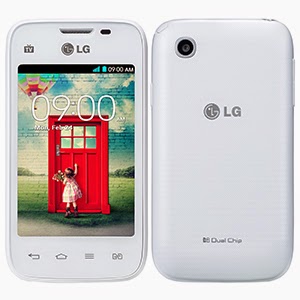 LG L35